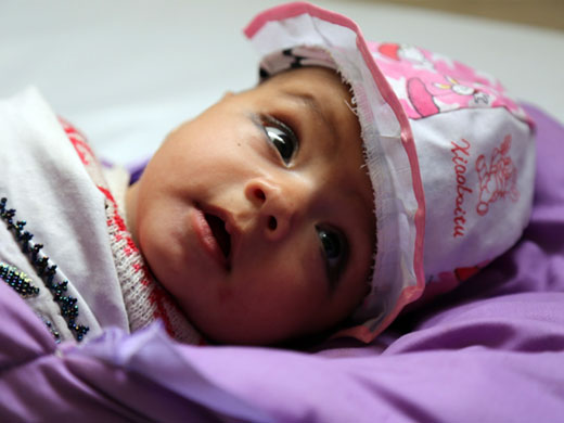 Parents of 5-month-old Maryam brought her to the WHO-supported leishmaniasis treatment centre at the National Malaria and Leishmaniasis Treatment Control Programme of the Ministry of Public Health in Afghanistan. Maryam had lesions on her face and arms, caused by the bite of a sandfly that spreads leishmaniasis. To cure her lesions, she received injections of sodium stibogluconate provided by WHO.
