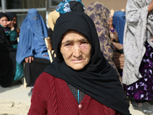”This is the third time I am coming to this treatment centre to get my medicine injections,” said Manizha, who is waiting for her turn in front of the leishmaniasis treatment centre in Kabul. “This place is very far from my home and it is not easy for me to come here. Many people in my neighbourhood have this same disease so we often come here together to get our medicines.” Leishmaniasis can affect people of all ages. The disease creates a heavier social burden particularly on younger women and girls due to the stigma associated with lesions and scarring caused by the sandfly bites.
