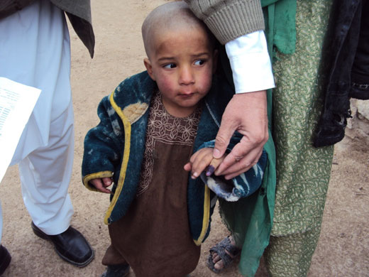 As a consequnces of intense efforts, no child has been reported as having paralysis due to poliomyelitis in Uruzgan this year, 2012.