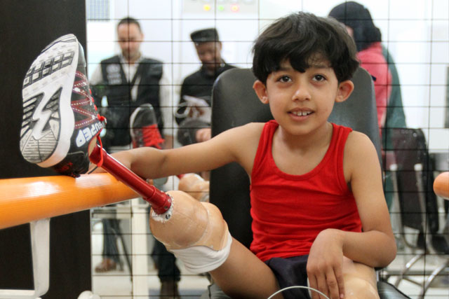 To address shortages in prosthetic and orthotic devices, WHO collaborates with the Directorate of Physical Rehabilitation to increase the local production and maintenance of fitted devices. WHO has provided 5341 disabled people across Syria with prosthetic/assistive devices and donated manufacturing equipment, artificial limbs and accessories for prosthetic devices to national health authorities.