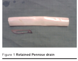Figure 1 Retained Penrose drain