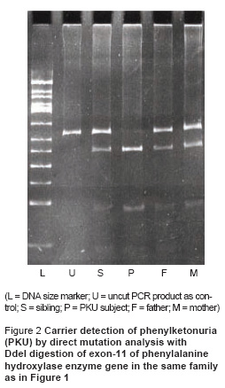 Figure 2 Carrier detection of phenylketonuria  (PKU) by direct mutation analysis with  DdeI digestion of exon-11 of phenylalanine  hydroxylase enzyme gene in the same family  as in Figure 1