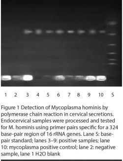 Figure 1 Detection of Mycoplasma hominis by polymerase chain reaction in cervical secretions. Endocervical samples were processed and tested for M. hominis using primer pairs specific for a 324 base-pair region of 16 rRNA genes. Lane S: base-pair standard; lanes 3–9: positive samples; lane 10: mycoplasma positive control; lane 2: negative sample, lane 1 H2O blank