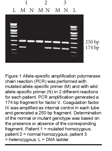 Figure 1 Allele-specific amplification polymerase chain reaction (PCR) was performed with mutated allele-specific primer (M) and with wild allele-specific primer (N) in 2 different reactions for each patient. PCR amplification generated a 174 bp fragment for factor V. Coagulation factor IX was amplified as internal control in each tube and generated a 250 bp fragment. Determination of the normal or mutant genotype was based on the presence or absence of the corresponding fragment. Patient 1 = mutated homozygous; patient 2 = normal homozygous; patient 3 = heterozygous; L = DNA ladder