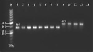 Figure 2 Agarose gel electrophoresis of amplification products of second reaction of SnM-PCR [lane M: 50 bp marker DNA ladder; lanes 1–8: Plasmodium falciparum (395bp); lanes 9–12: Plasmodium vivax (499 bp); lane 13: negative control]
