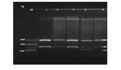 Figure 1 Detection of the HFE C282Y mutation by PCR-RFLP with C282Y primers and digested with restriction enzyme Rsa1. Lane M: DNA marker. Lanes 1, 2, 3 & 5: normal C282Y allele (296 &145 bp). Lane 4: heterozygote alleles (296, 145, 116 & 29 bp).