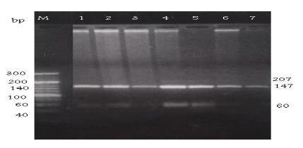 Figure 3 Detection of the HFE S65C mutation by PCR-RFLP with S65C primers and digested with restriction enzyme Hinf1. Lane M: DNA marker. Lanes 1, 2, 3 & 6: normal S65C wild allele digested bands (147 & 60 pb). Lanes 4 & 5: heterozygotes for S65C mutant allele showing normal digested bands (147 & 60 pb) as well as the undigested amplified fragment (207). Lane 7: homozygote for S65C mutant allele show undigested band (207 pb).