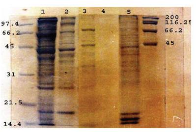 Figure 1 Coomassie staining profile of SDS-12.5% PAGE resolved soluble female worm antigen (lane 1), soluble male worm antigen (lane 2), crude female worm surface antigen (lane 3), female worm extracted–secretory antigen (lane 4) and microfilarial antigen (lane 5) under reducing conditions in comparison to low (left) and high (right) molecular weight markers