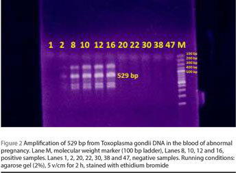 Figure 2 Amplification of 529 bp from Toxoplasma gondii DNA in the blood of abnormal pregnancy. Lane M, molecular weight marker (100 bp ladder), Lanes 8, 10, 12 and 16, positive samples. Lanes 1, 2, 20, 22, 30, 38 and 47, negative samples. Running conditions: agarose gel (2%), 5 v/cm for 2 h, stained with ethidium bromide