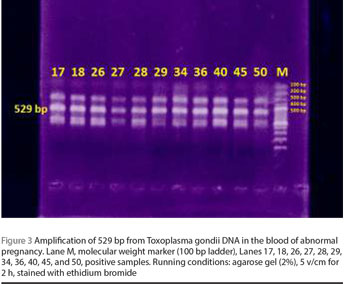 Figure 3 Amplification of 529 bp from Toxoplasma gondii DNA in the blood of abnormal pregnancy. Lane M, molecular weight marker (100 bp ladder), Lanes 17, 18, 26, 27, 28, 29, 34, 36, 40, 45, and 50, positive samples. Running conditions: agarose gel (2%), 5 v/cm for 2 h, stained with ethidium bromide