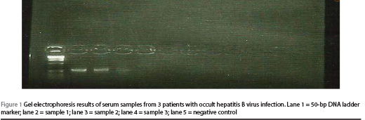 Figure 1 Gel electrophoresis results of serum samples from 3 patients with occult hepatitis B virus infection. Lane 1 = 50-bp DNA ladder marker; lane 2 = sample 1; lane 3 = sample 2; lane 4 = sample 3; lane 5 = negative control