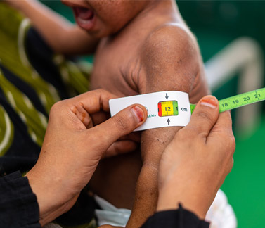 WHO and UAE launch joint programme to reduce malnutrition among Yemenis on Socotra Island