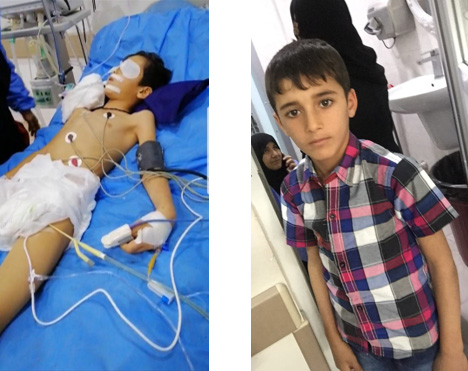 Heman Adnan, 7 years old admitted to Hevi facility with inflammation of the brain and status epilepticus and was discharged with full recovery. Photo: WHO Iraq, 2020