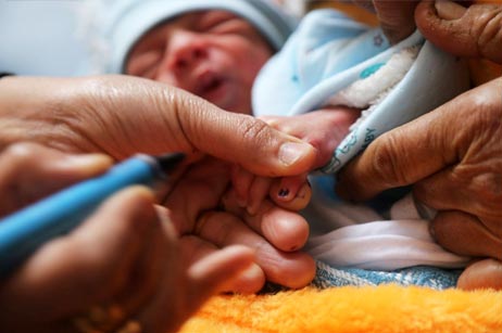 An 11-day old baby gets his finger marked after receiving OPV