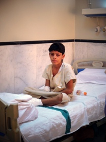 11-year-old Maher from Qamishli was playing with his friends when a heavy mortar shelling fell on his village. He lost his left eye and his right arm was severely injured.