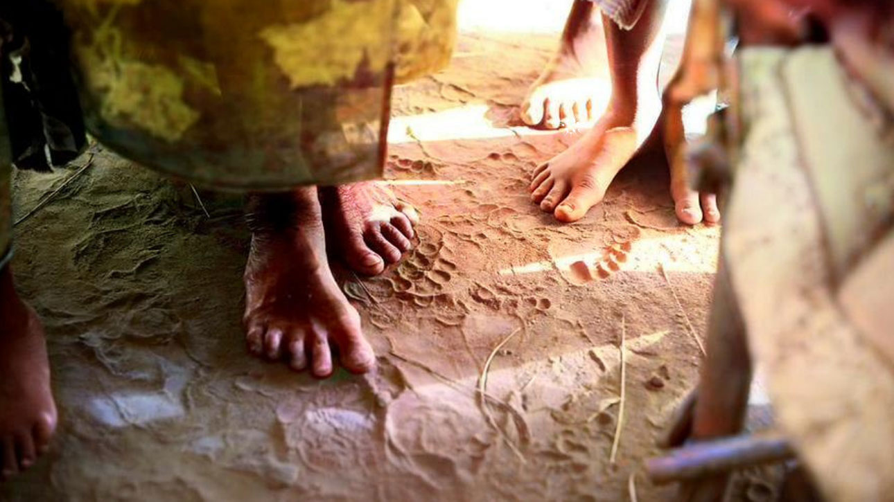 Mycetoma: a neglected disease affecting thousands of people