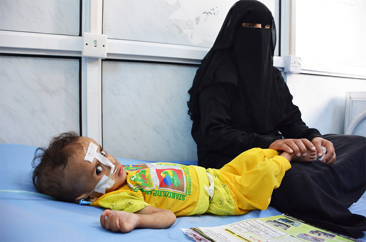 حوالي 1.8 مليون طفل ما دون سن الخامسة في اليمن يعانون من سوء التغذية الحاد، بما فيهم 400 ألف طفل يعانون من سوء التغذية الحاد الوخيم