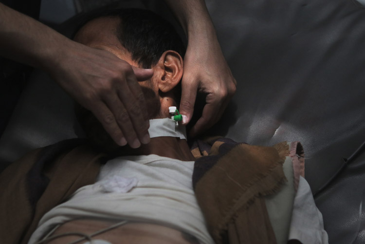 مع ما يقارب 70 ألفاً من الإصابات في اليمن، تلبي عمليات المفوضية الأوروبية للمساعدات الإنسانية والحماية المدنية بالشراكة مع منظمة الصحة العالمية إحتياجات رعاية الإصابات الحرجة