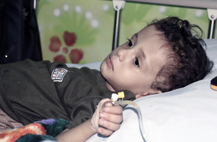 تواجه العديد من أسر المرضى ممن يعانون من أمراض مزمنة، مثل الطفل حسين، ظروفاً قاسية وصراعاً مستمراً للحصول على الرعاية الطبية.  (تصوير: صادق الوصابي/ منظمة الصحة العالمية)