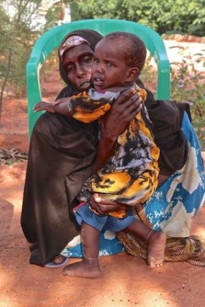 عائشة محمد البالغ عمرها سنتين من منطقة جاريبان كانت هي أول مصابة بشلل الأطفال في الصومال في عام 2014. وعندما أصبحت غير قادرة على المشي أحضرتها أمها المذعورة إلى غالكايو. اليونيسيف الصومال/2014/ماكوندي