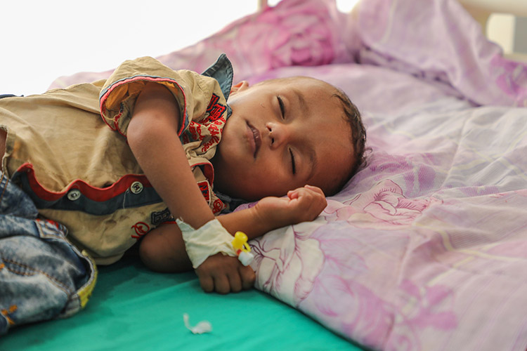 سوء التغذية الحاد يهدد حياة نصف الأطفال دون الخامسة في العام 2021 في اليمن