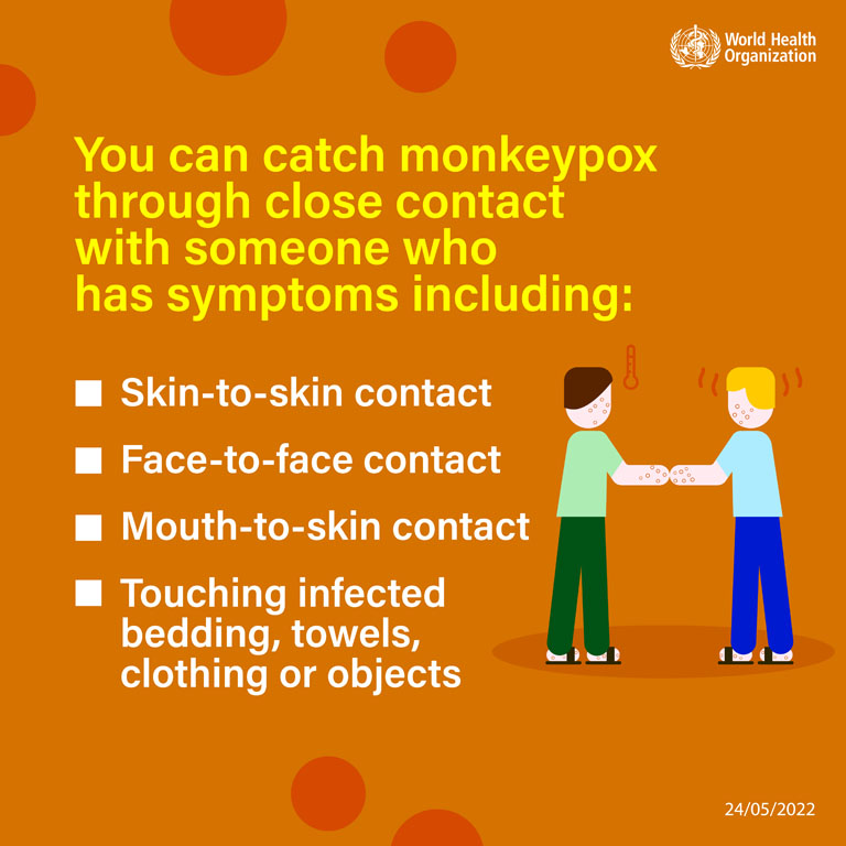 Monkeypox social media card - 4 - English