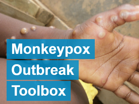 Surveillance, case investigation and contact tracing for Monkeypox