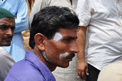 Patient with skin disease following the flood in Thatta, Sindh 