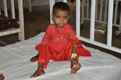 A young girl recovering after treatment in a civil hospital in Sanghar, Sindh