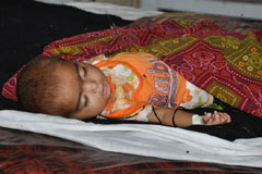 A young girl recovering after treatment in a civil hospital in Sanghar, Sindh