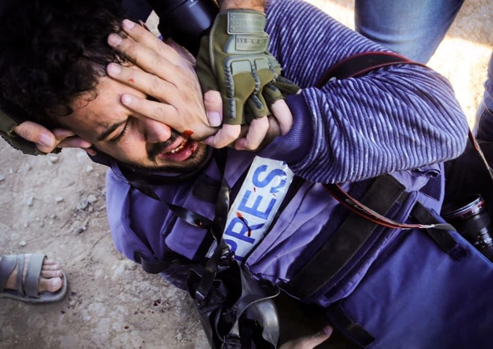 Injured journalist prevented from accessing health care