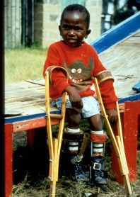 L'image nous montre un enfant paralysé s'appuyant sur des béquilles