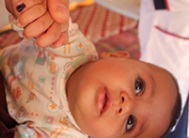 تحصين كافة الأطفال ضد شلل الأطفال في الأردن