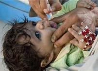 L’image nous montre un enfant recevant le vaccin antipoliomyélitique oral