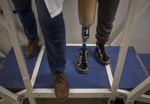 A_physiotherapist_at_the_Directorate_of_Disability_and_Physical_Rehabilitation_in_Damascus_stands_next_to_Gofran_15._She_lost_her_leg_after_stepping_on_a_landmine_in_northeast_Syria