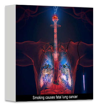Fumer provoque le cancer mortel du poumon