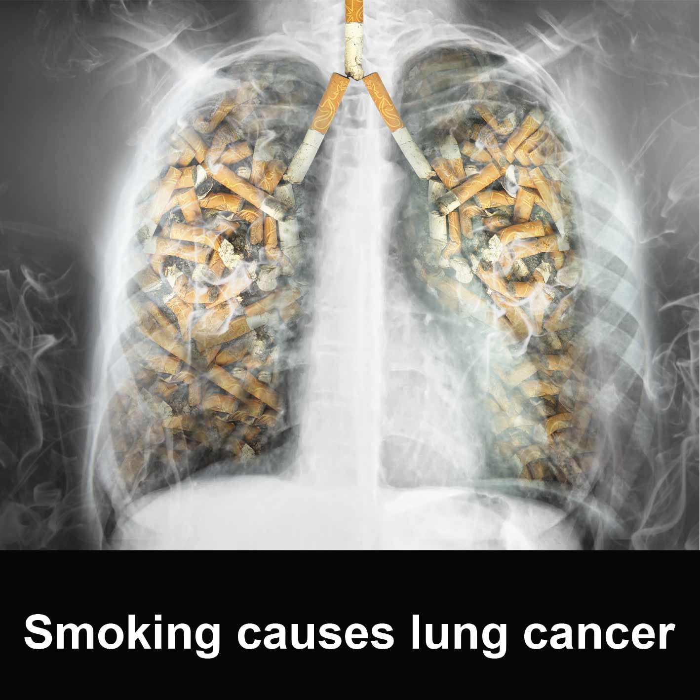 smoking-causes-lung-cancer