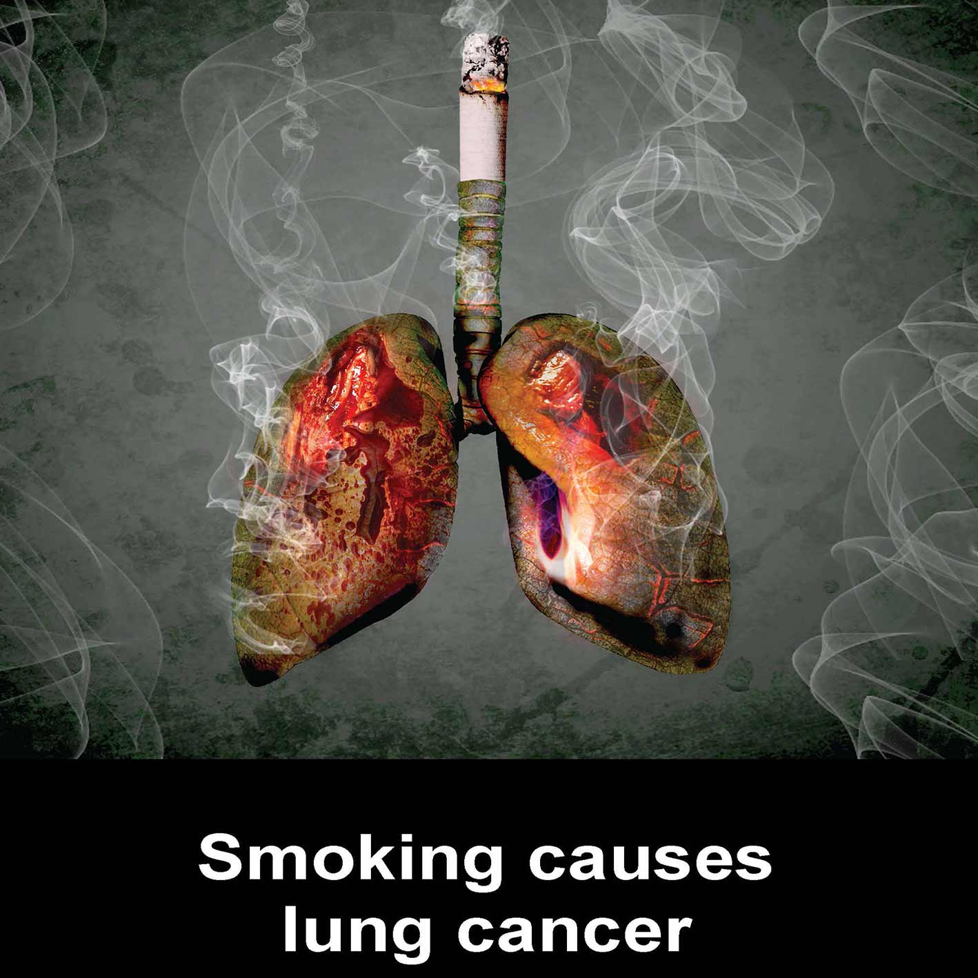 smoking-causes-lung-cancer