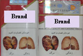 Image shows multiple displays of pictorial health warnings from the Islamic Republic of Iran on how smoking impacts the lungs, causing cancer.