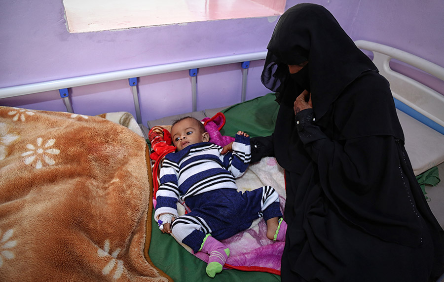 A caregiver next to her malnourished baby at the therapeutic feeding centre in AL-Humjori Hospital, Hajjah City.