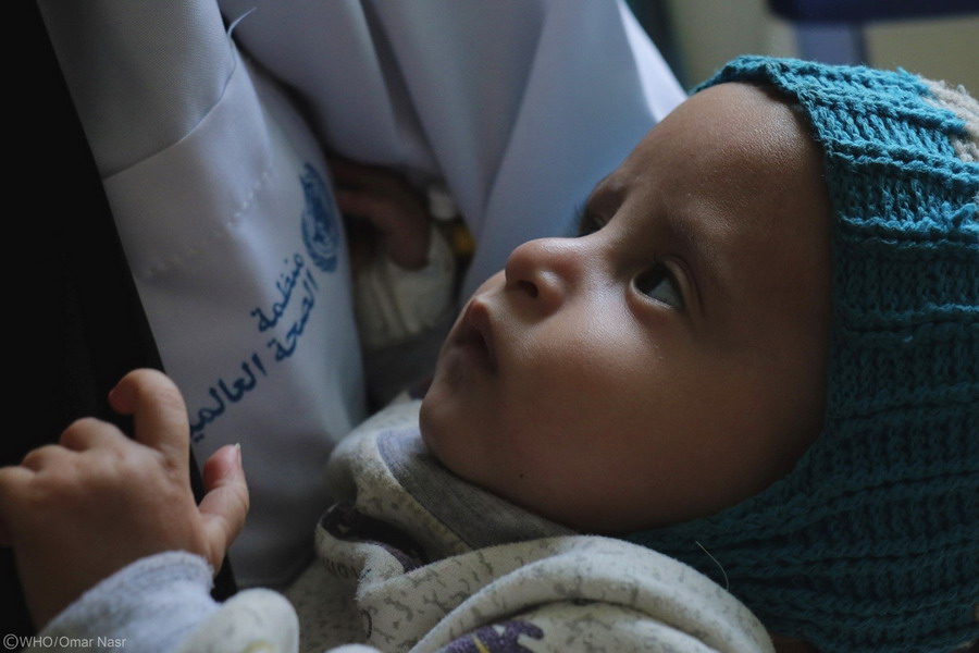 With the support of Germany, WHO and INTERSOS provide life-saving medical care to children in Ibb governorate
