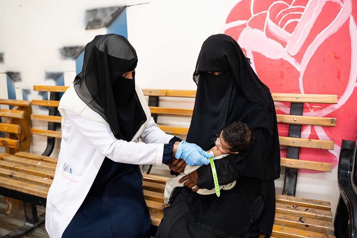  معاناة أطفال اليمن بين النزوح وسوء التغذية