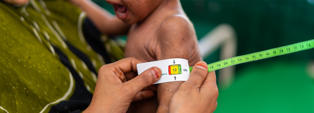 WHO and UAE launch joint programme to reduce malnutrition among Yemenis on Socotra Island