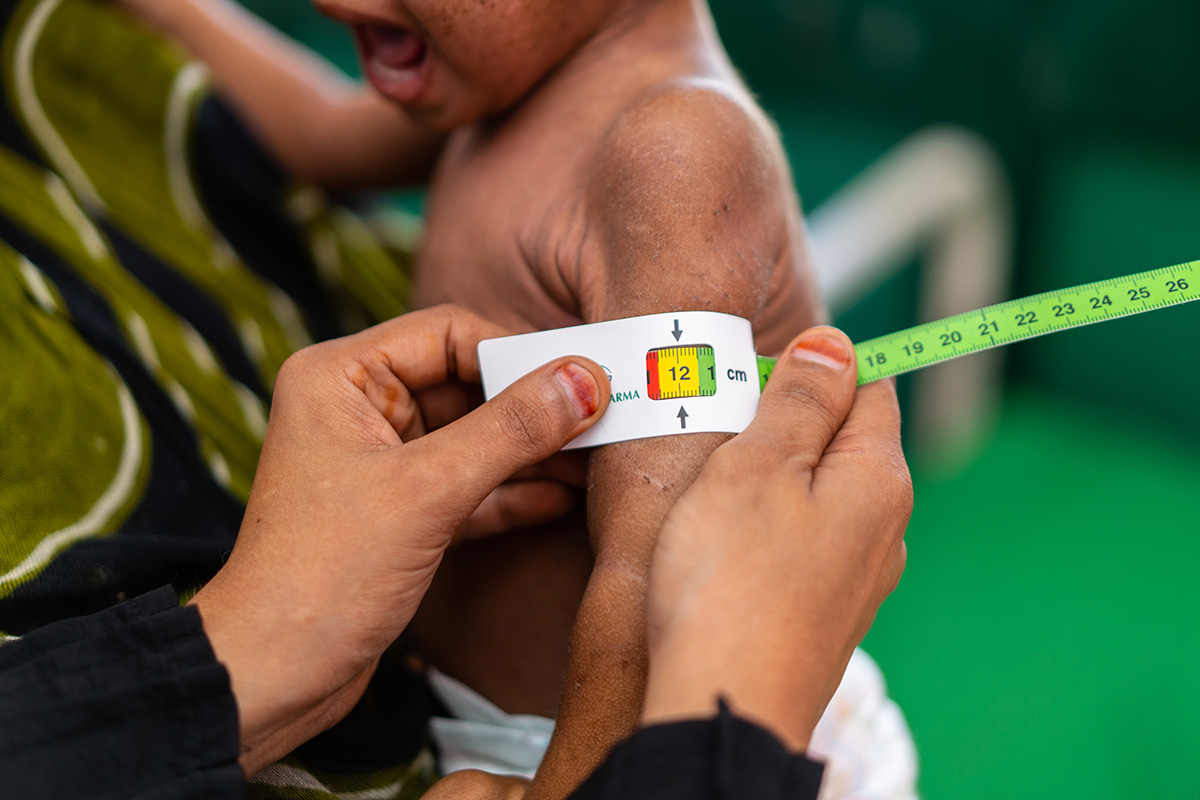 WHO and UAE launch joint programme to reduce malnutrition among Yemenis on Socotra Island