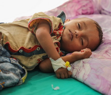 Acute malnutrition threatens half of children under 5 in Yemen in 2021: United Nations