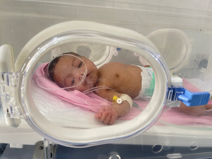 A fighting chance for children born prematurely in Yemen