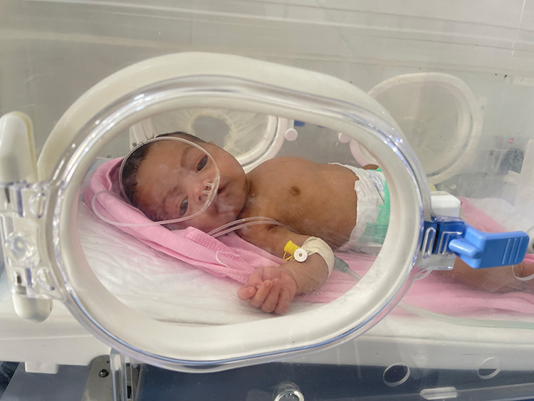بصيص أمل للأطفال المولودين قبل الأوان (الخدج) في اليمن 