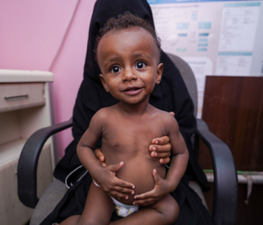 Acute food insecurity threatens child survival across Yemen