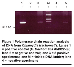Figure 1 Polymerase chain reaction analysis of DNA from Chlamydia trachomatis. Lanes 1 = positive control (C. trachomatis AMS22-3); lane 2 = negative control; lane 3 = 5 positive specimens; lane M = 100 bp DNA ladder; lane 4 = negative specimens