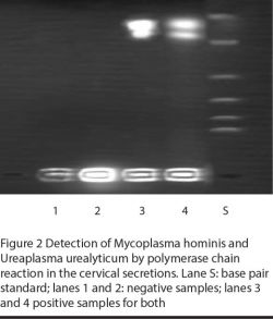 Figure 2 Detection of Mycoplasma hominis and Ureaplasma urealyticum by polymerase chain reaction in the cervical secretions. Lane S: base pair standard; lanes 1 and 2: negative samples; lanes 3 and 4 positive samples for both